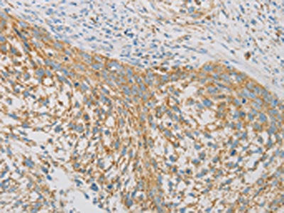 REN Antibody