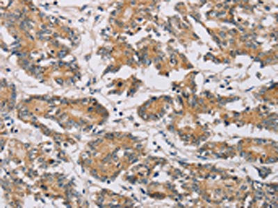 MTFR1 Antibody