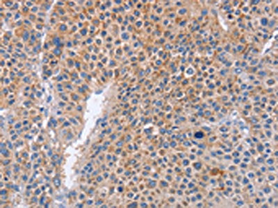 PLK1 Antibody