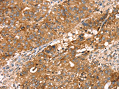 PDLIM4 Antibody
