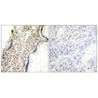 CDKN2A Antibody