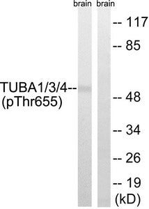 Phospho-TUBA1A/TUBA1B/TUBA1C/TUBA3C/TUBA3E/TUBA4A (Tyr272) Antibody