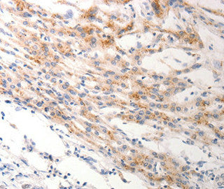 KRT6B Antibody