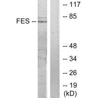 FES Antibody