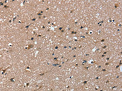 TRIM31 Antibody