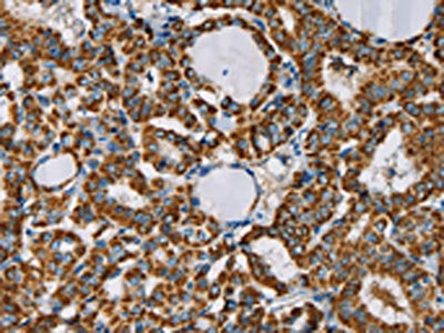 CMC4 Antibody