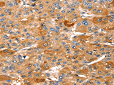 STK33 Antibody