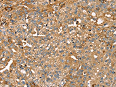 ROBO3 Antibody