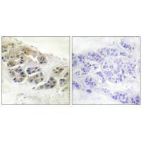 SCGB2A2 Antibody