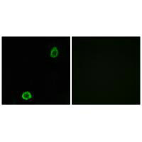 ABCA13 Antibody