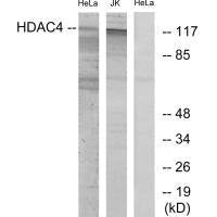 HDAC4 (Ab-632) Antibody