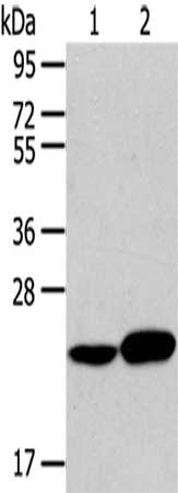 RAB8A Antibody