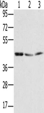 RBMX Antibody