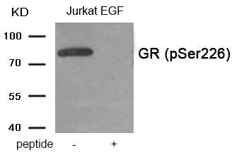Phospho-NR3C1 (Ser226) Antibody