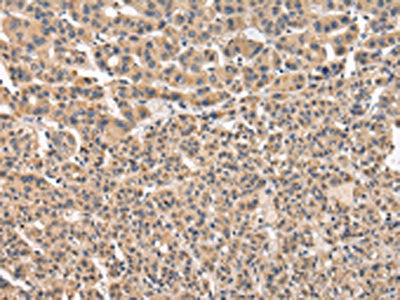 VPS41 Antibody