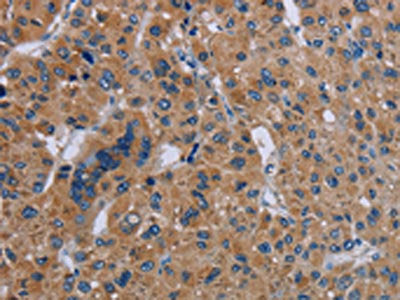 IL27RA Antibody
