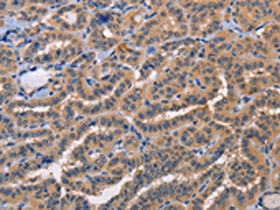 AKR1B10 Antibody