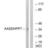 AASDHPPT Antibody