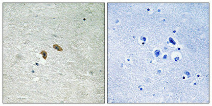 Phospho-RAF1 (Thr269) Antibody