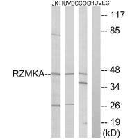 RIMKLA Antibody