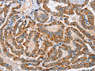 MSMB Antibody