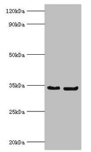 P Antibody