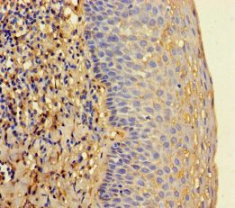 RNASEL Antibody