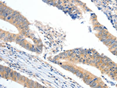 APOB Antibody