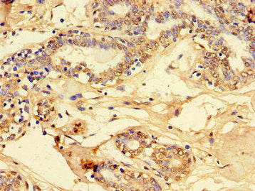 PET100 Antibody