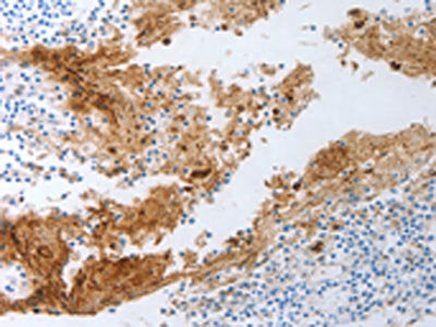 NGFR Antibody