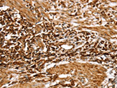 RPLP1 Antibody