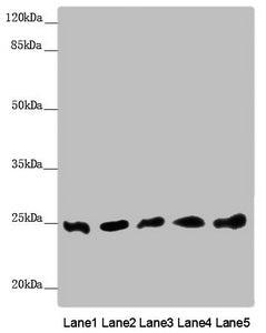 EEF1B2 Antibody