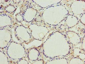CMC4 Antibody