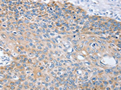 RNF185 Antibody