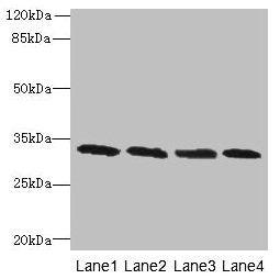 PNP Antibody