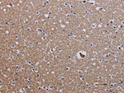 ZC3H12A Antibody