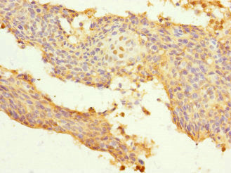 SNRPB2 Antibody