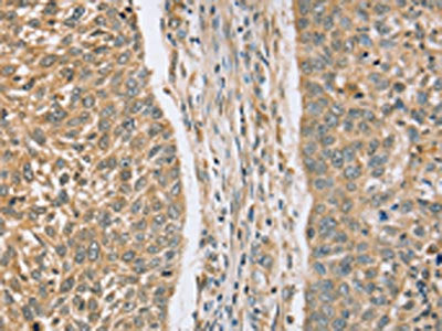 RASSF4 Antibody