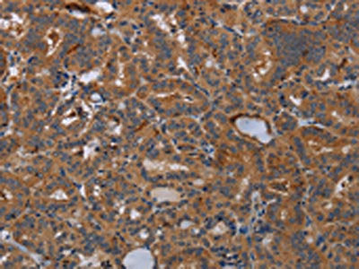 KLK13 Antibody