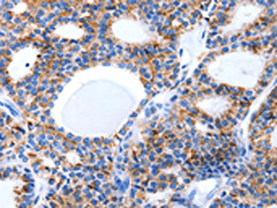 LAMA5 Antibody
