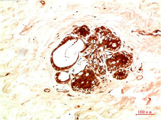JAK2 Antibody