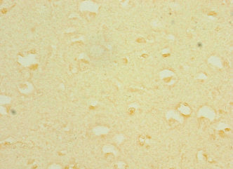TRPC5 Antibody
