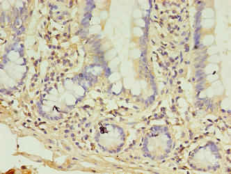 COL6A6 Antibody
