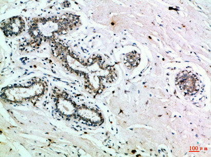 INSR Antibody