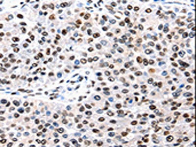 AQP2 Antibody