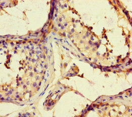 ARHGAP42 Antibody