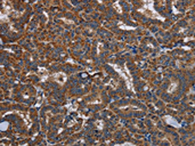 LYN Antibody