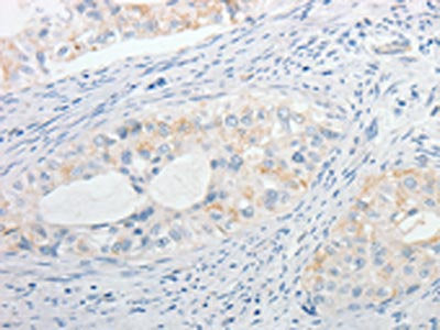 MPZ Antibody