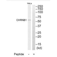 CHRNB1 Antibody
