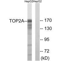 TOP2A (Ab-1343) Antibody